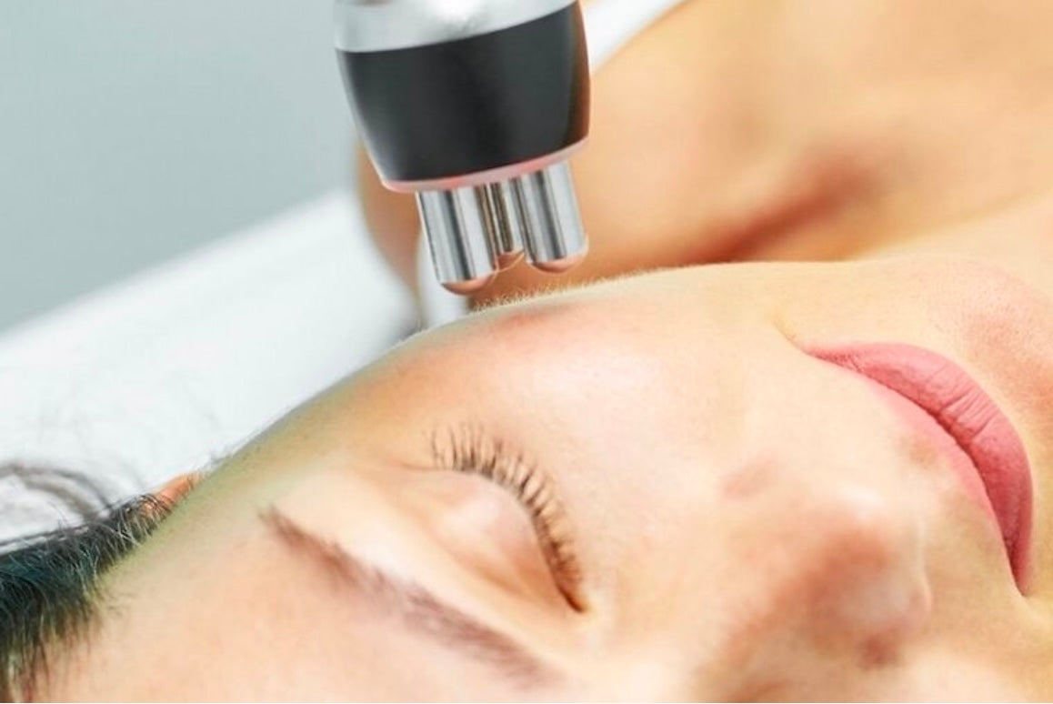 Tratamiento de Radiofrecuencia