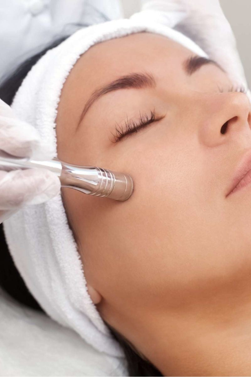 Limpieza Facial Profunda y Microdermoabrasión